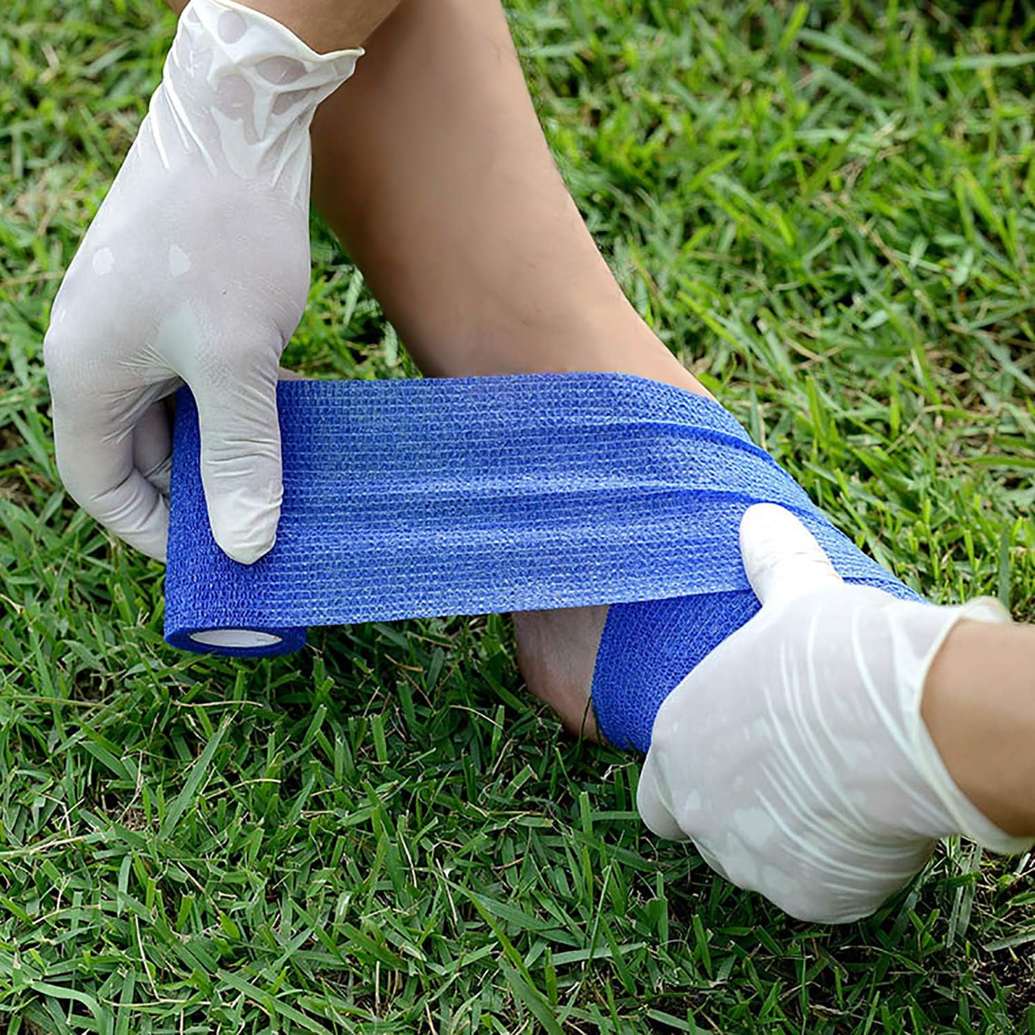 Cómo los vendajes autoadhesivos ayudan a controlar las ampollas y las quemaduras menores